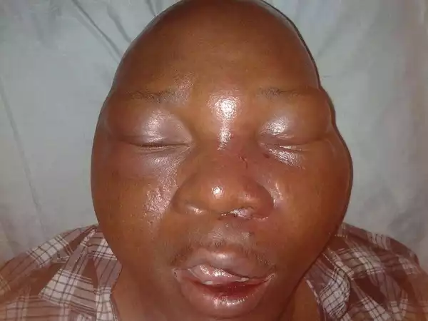 Photo: Smugglers At Badagry Beat Journalist To Coma 