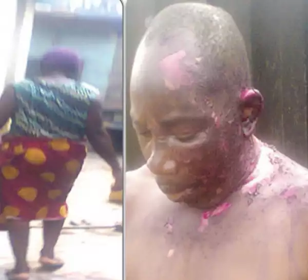 Photos: Lagos Wife Pours Hot Water On Her Husband For Constantly Beating Her
