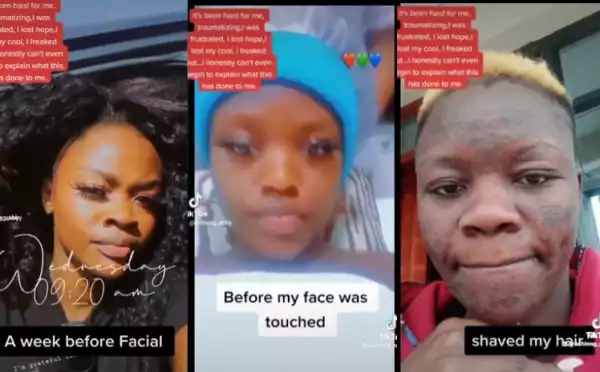 Nigerian Model Shares Video Showing How Her Face Was Damaged After Going For A Facial (Video)